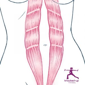 Diastasis recti social media image