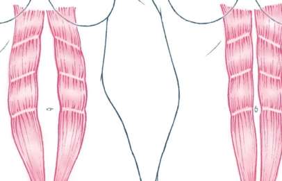 image of diastasis recti test